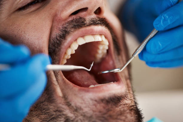Best Emergency Dental Care for Broken or Chipped Teeth in Spring Lake Park, MN